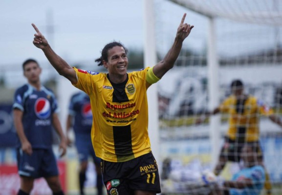 Douglas Caetano aparece en un Live de Instagram y sorprende con su maltratada apariencia