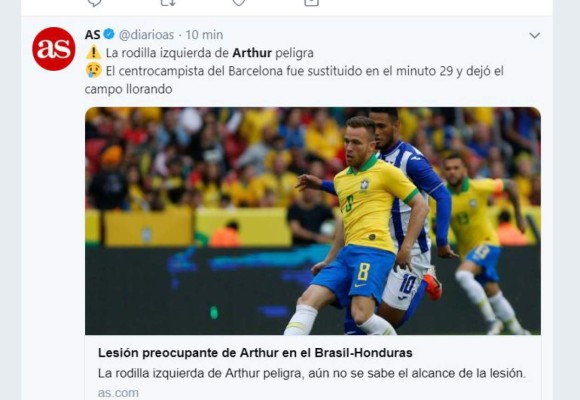 Lesión de Arthur ante Honduras invade las portadas internacionales