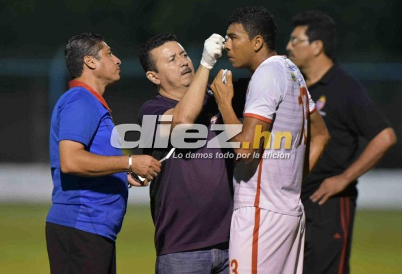 ¡QUÉ DRAMÁTICO! La espeluznante lesión de Donis Escober