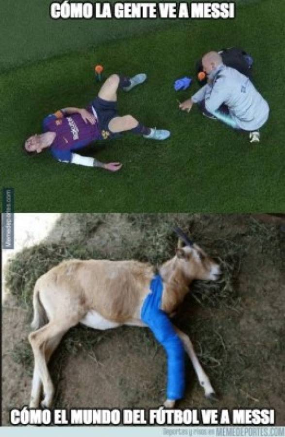 ¡No perdonan! Los memes tras la lesión de Messi; Vidal también es atacado