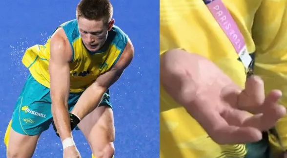 Se amputa un dedo para estar en los Juegos Olímpicos de París: “Tome la decisión, llamé a mi mujer y me dijo...”