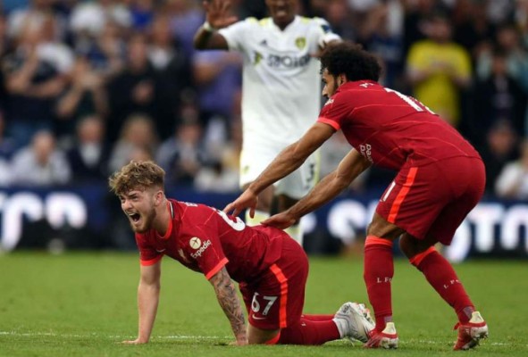 No apto para sensibles: Así fue la escalofriante lesión de Harvey Elliott del Liverpool; sufrimiento y shock de Klopp&nbsp;&nbsp;