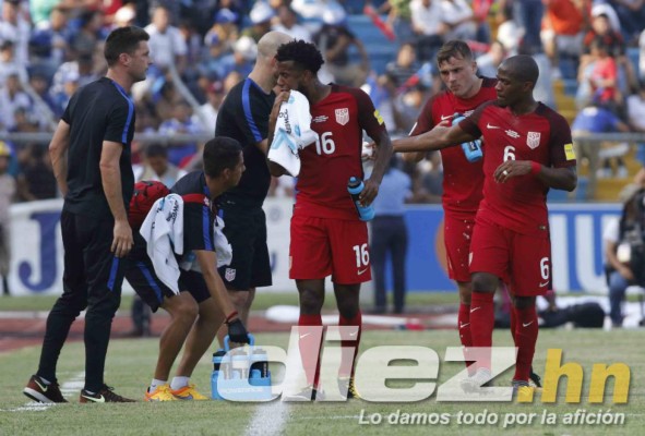 NO VISTE EN TV: EUA termina fundido y la frustración de Honduras tras el juego