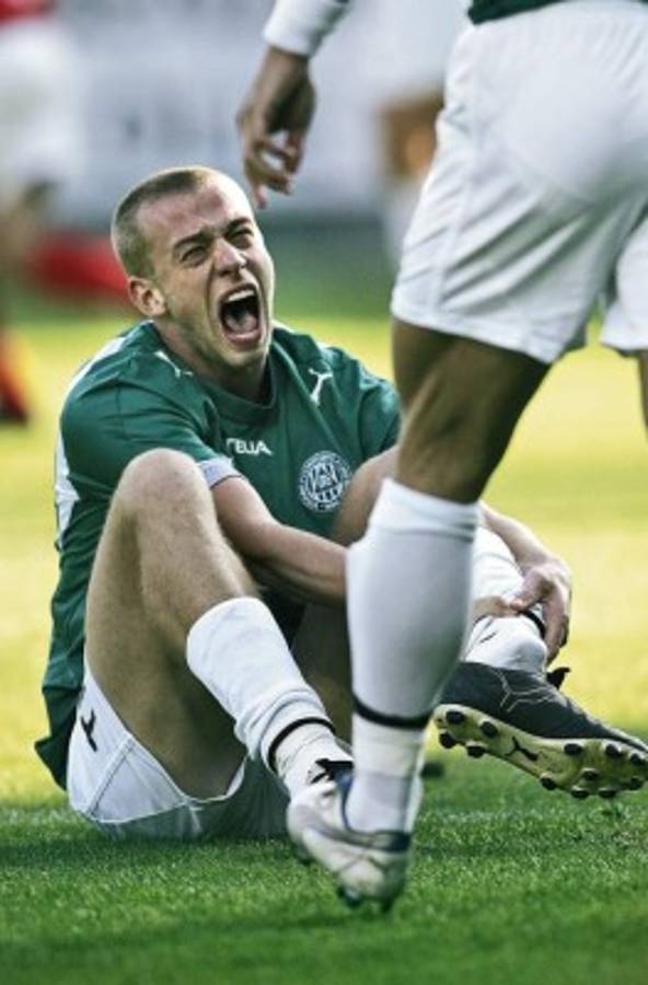 Estas son las lesiones más terribles en la historia del fútbol