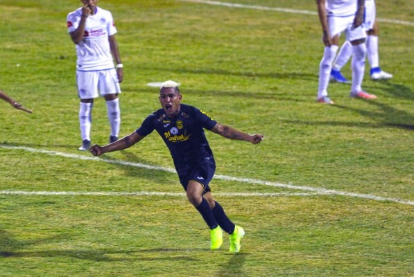 Los jugadores que han sido confirmados como bajas en los clubes de Liga Nacional