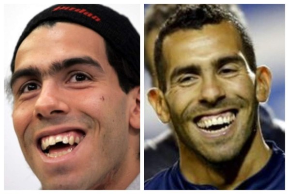 Cristiano Ronaldo el más llamativo: Deportistas famosos a los que el dentista les cambió la vida&nbsp;&nbsp;