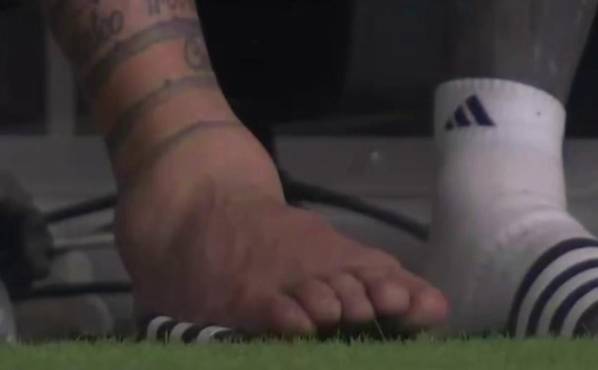 Así le quedó el tobillo a Leo Messi después de la jugada donde se cayó.