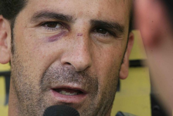 FOTOS: Los golpes y lesiones más brutales del fútbol hondureño