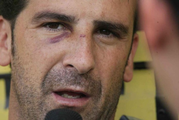 FOTOS: Las lesiones y golpes más dramáticas del fútbol hondureño