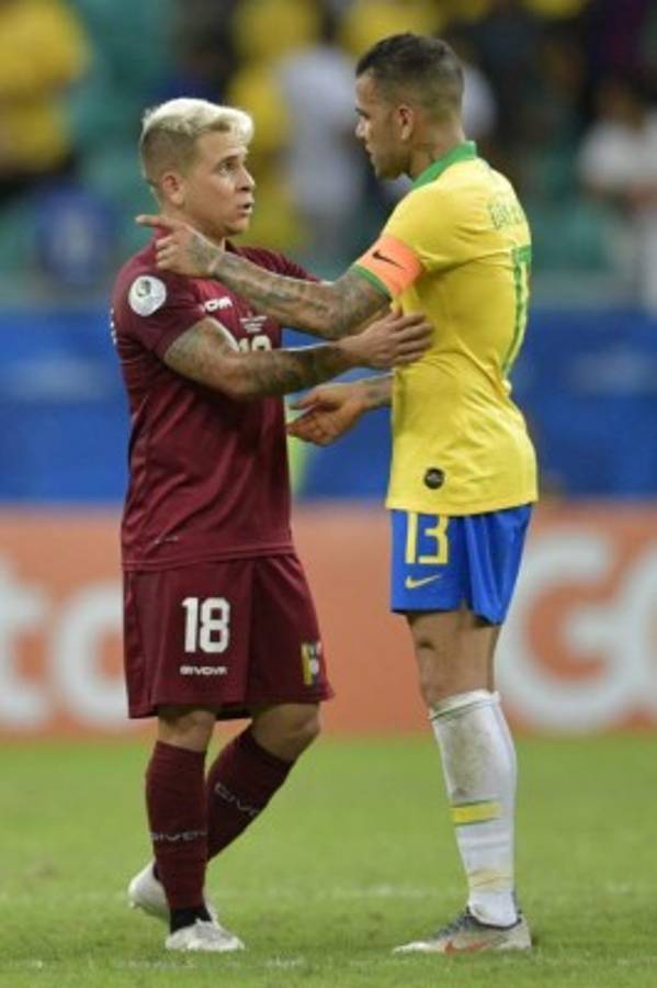 No viste en TV: El dolor de Brasil, la lindas garotas y el aburrido frente a Venezuela