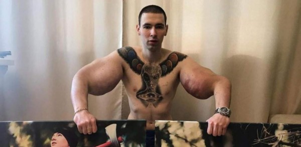 La fea lesión del Popeye ruso: le 'explotan' un brazo en plena pelea y anuncia que es el final