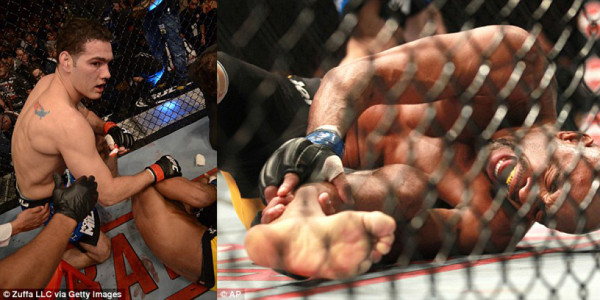 VIDEO: Espeluznante fractura de Anderson Silva en la UFC