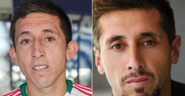 Futbolistas que se han hecho cirugía estética para verse mejor