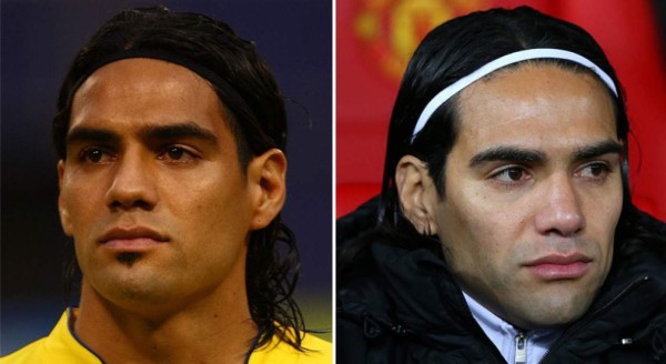 Futbolistas que recurrieron al bisturí para mejorar su apariencia física