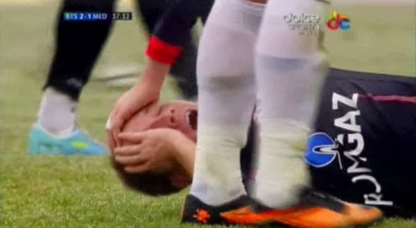 VIDEO: Escalofriante lesión en fútbol rumano
