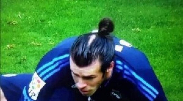 Los peinados de Gareth Bale que la alopecia le ha hecho cambiar
