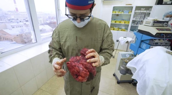 El rotundo cambio del 'Popeye' ruso: se sometió a una cirugía para salvar su vida