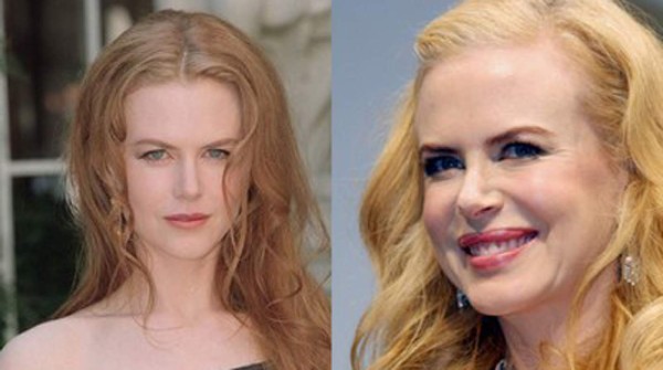 Maradona y las estrellas del espectáculo con tratamiento estético