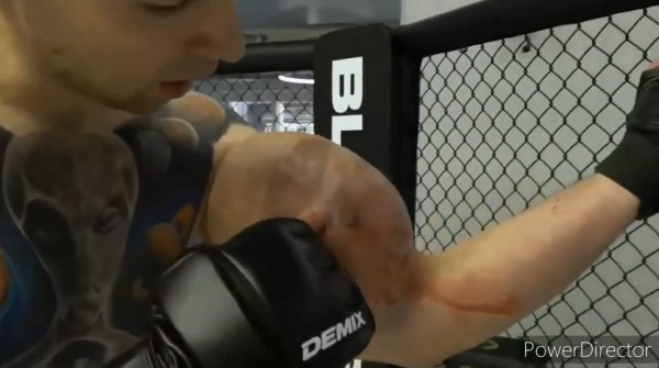 La fea lesión del Popeye ruso: le 'explotan' un brazo en plena pelea y anuncia que es el final