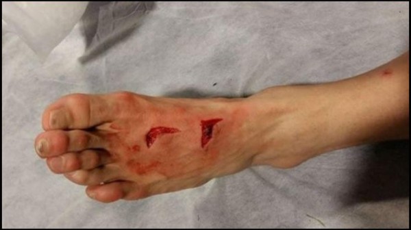 ¡ESCALOFRIANTE! La brutal entrada que recibió Héctor Herrera contra la Juventus