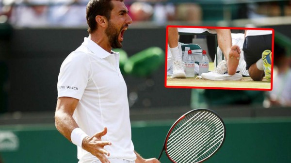 ¡HORRIBLES! Así son los pies más feos de los deportistas famosos