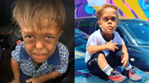 ¿Quién es Quaden Bayles, el niño que sufrió bullying y le pidió a su madre que le quitara la vida?