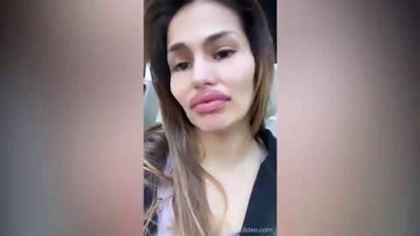 '¿Qué te ha pasado?' Mujer de crack del Real Madrid es atacada por su impactante aumento de labios&nbsp;&nbsp;