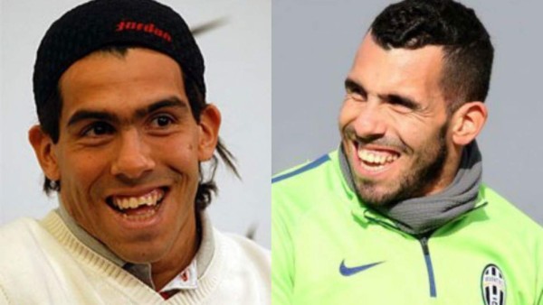 Futbolistas que se han hecho cirugía estética para verse mejor