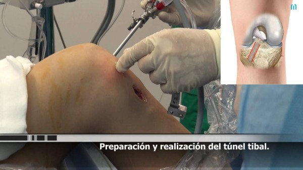 Las espeluznantes y temibles operaciones a los futbolistas