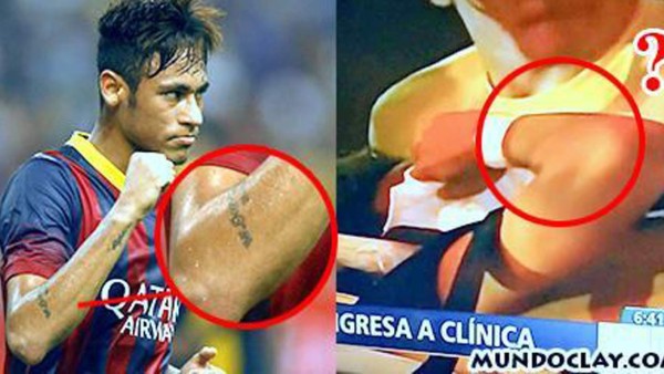 Fractura de Neymar ¿Un montaje brasileño?