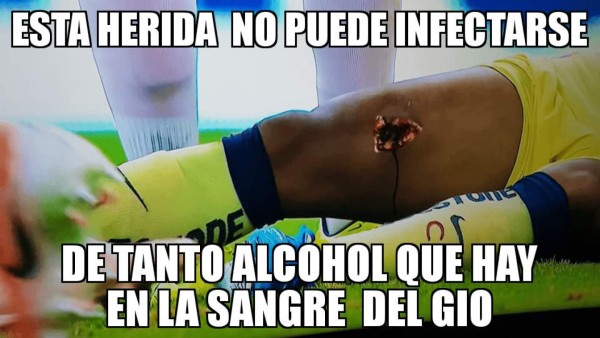 Giovanni dos Santos, víctima favorita de los memes luego del clásico América - Chivas en México