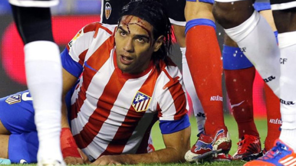 VIDEO: Terrible jugada deja sangrando a Falcao