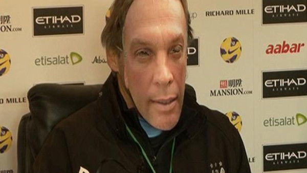 Roberto Mancini se presenta con careta a conferencia