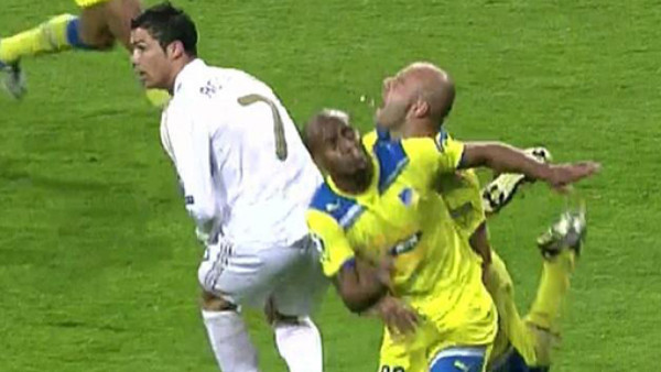 Perdió tres dientes y siguió jugando contra Real Madrid