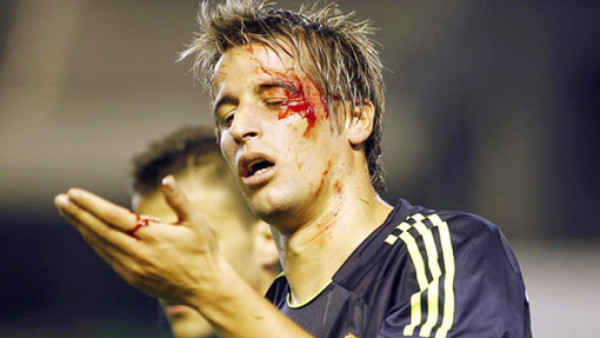 Otro corte de ceja para el Real Madrid, esta vez le tocó a Coentrao