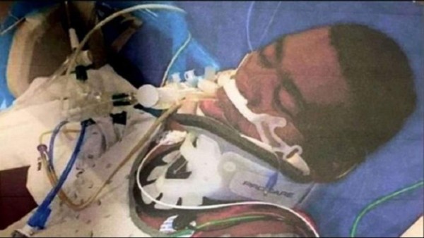 Fue figura del PSG, sufrió una lesión de rodilla y lleva 39 años en estado vegetativo; su esposa no pierde la esperanza