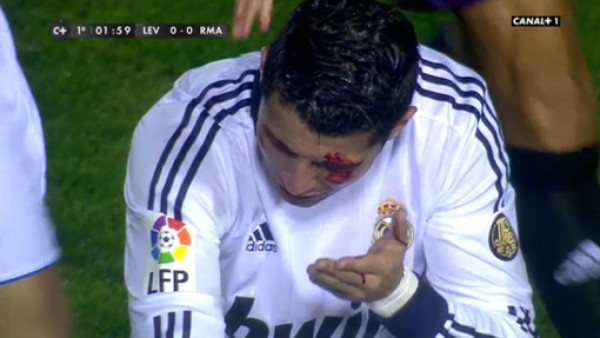 VIDEO: Tremendo codazo a Cristiano