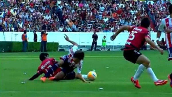 VIDEO: Futbolista de Chivas sufre dramática lesión y sigue jugando