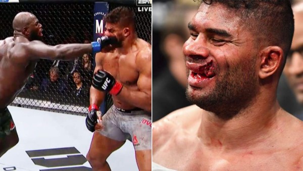 ¡Terribles fotos! De un brutal golpe le rompen los labios a un peleador en la UFC