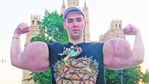 La fea lesión del Popeye ruso: le 'explotan' un brazo en plena pelea y anuncia que es el final