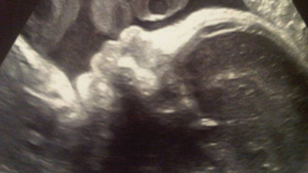 ¡La primera foto del hijo de Shakira y Gerard Piqué!