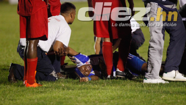 Panameño Mosquera, fracturado de tibia y peroné