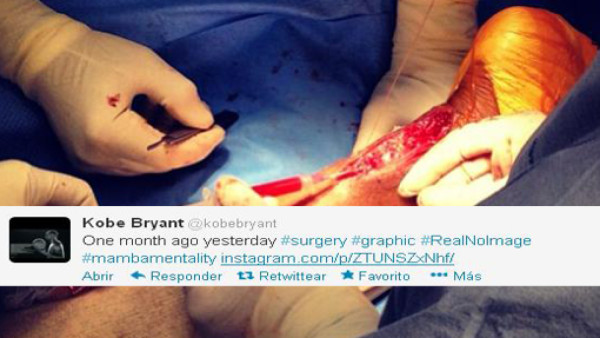 Escalofriante imagen de la operación de Kobe Bryant