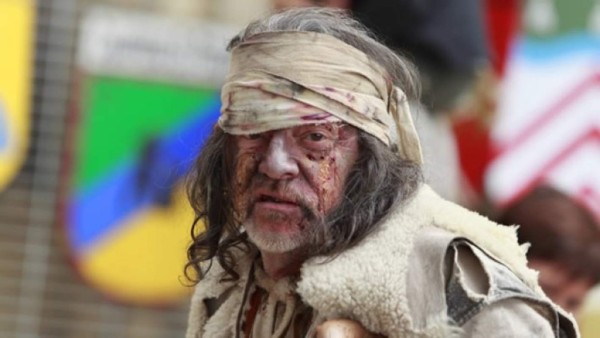 Alerta en México tras reportarse 89 casos de lepra, algo que pone en vigilancia al sector salud