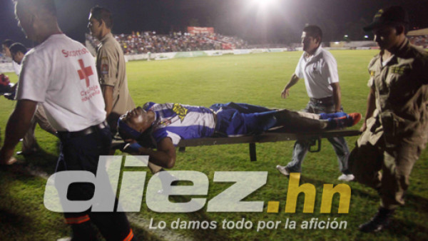 Panameño Mosquera, fracturado de tibia y peroné