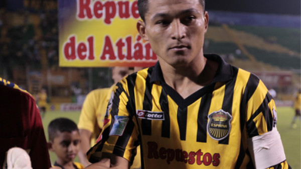 El gafete de capitán que tuvo que utilizar Edder Delgado