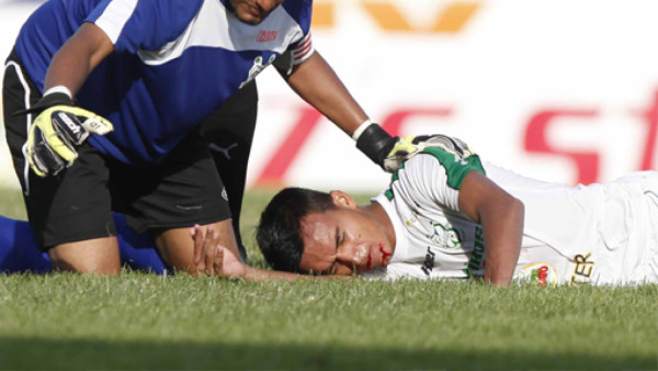 Odis Borjas perdió dos dientes ante Vida