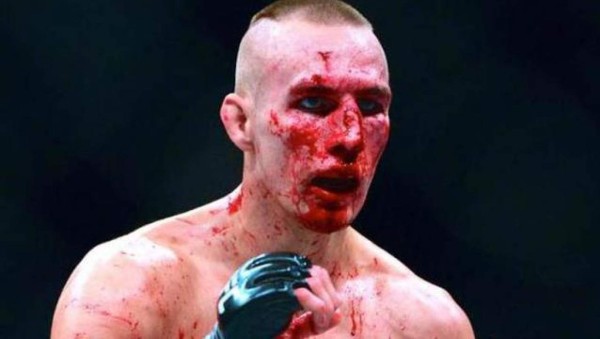 Fotos: Los golpes más espeluznantes en la UFC