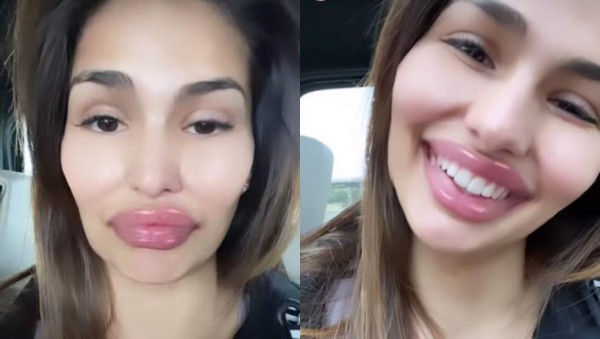 '¿Qué te ha pasado?' Mujer de crack del Real Madrid es atacada por su impactante aumento de labios&nbsp;&nbsp;