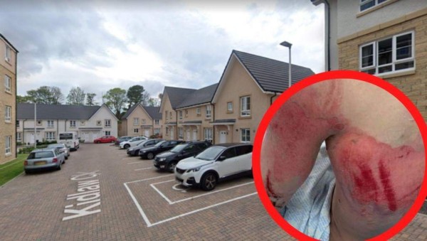 Cara desfigurada y huesos rotos: La paliza que le dieron a un soldado tras ser secuestrado en una cita de Tinder